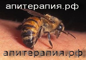 Апитерапия. Лечение пчелами, пчелоужаливание на дому Петербург СПб и Ленобласть.